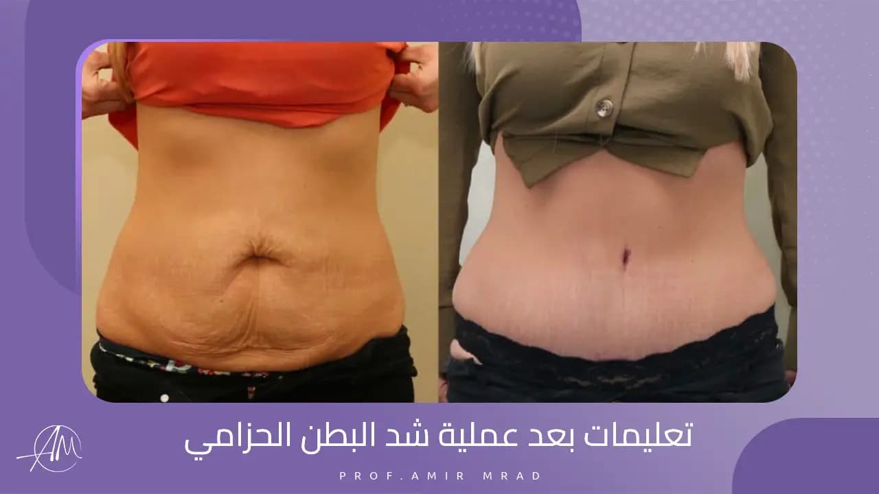 Tummy tuck operations