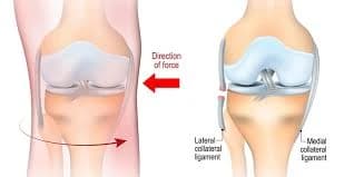 Cruciate ligament