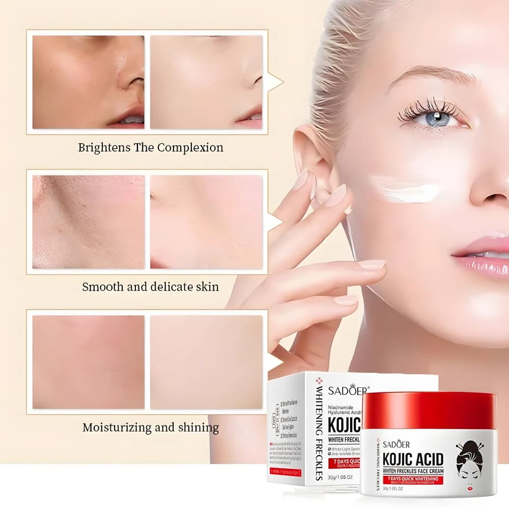 Kojic Acid Whiten Freckles Face Cream
