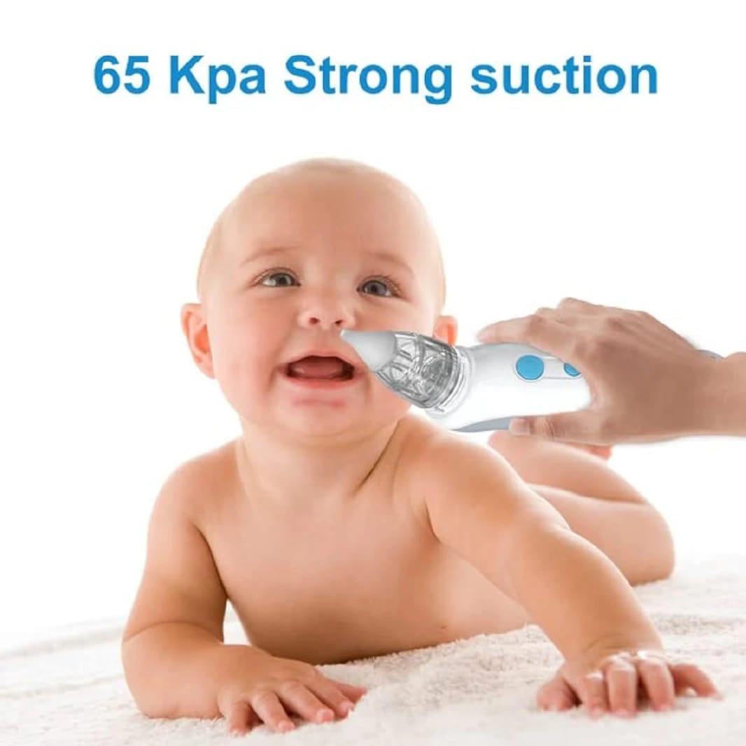 Electric Baby Nasal Aspirator – Mucus Suction Device with Music and 3 Suction Levels